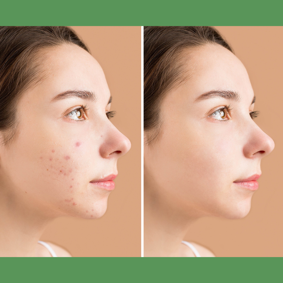 Xiangqimei Natural Exfoliating Cream Peeling Gel - Instant 30-Second Skin Renewal