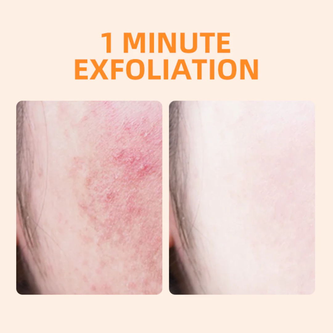 Xiangqimei Natural Exfoliating Cream Peeling Gel - Instant 30-Second Skin Renewal