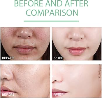 Xiangqimei Natural Exfoliating Cream Peeling Gel - Instant 30-Second Skin Renewal