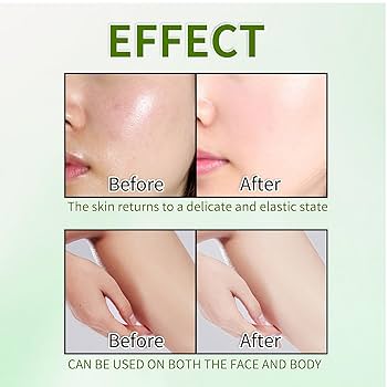 Xiangqimei Natural Exfoliating Cream Peeling Gel - Instant 30-Second Skin Renewal